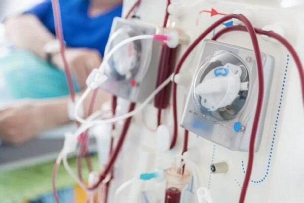En Argentina, hay 30.000 pacientes en diálisis crónica